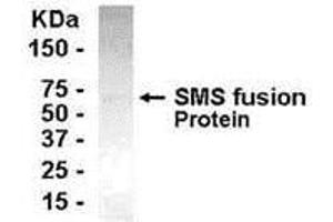 Western Blotting (WB) image for anti-Spermine Synthase, SMS (SMS) (AA 206-335) antibody (ABIN2467922)