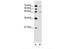 Image no. 1 for anti-Zinc Finger, FYVE Domain Containing 27 (ZFYVE27) (C-Term) antibody (ABIN205048) (ZFYVE27 antibody  (C-Term))