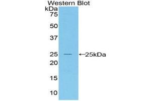 Detection of Recombinant Bax, Mouse using Polyclonal Antibody to Bcl2 Associated X Protein (Bax) (BAX antibody  (AA 1-158))