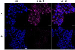 Immunocytochemical staining of HeLa cells using Flotillin 1 antibody (ABIN7798631), 1:1,000), Top panel: wild-type (WT), Bottom panal: Flotillin 1 shRNA knockdown (KD). (Recombinant Flotillin 1 antibody)