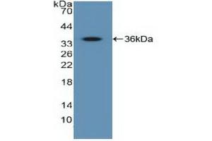 Detection of Recombinant IGF2R, Human using Polyclonal Antibody to Insulin Like Growth Factor 2 Receptor (IGF2R) (IGF2R antibody  (AA 2167-2442))
