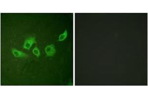 Immunofluorescence (IF) image for anti-V-Crk Sarcoma Virus CT10 Oncogene Homolog (Avian) (CRK) (AA 187-236), (pTyr221) antibody (ABIN1531222)