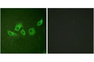 Immunofluorescence analysis of HuvEc cells, using CrkII (Phospho-Tyr221) Antibody. (Crk antibody  (pTyr221))