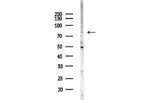 anti-TBX2/3 antibody