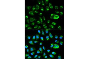 Immunofluorescence analysis of HeLa cell using GAS2 antibody. (GAS2 antibody  (AA 1-100))