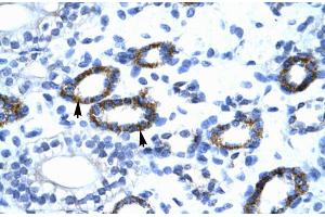 Human kidney (GTF2F2 antibody  (C-Term))