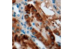 Immunohistochemical analysis of CBS staining in mouse kidney formalin fixed paraffin embedded tissue section. (CBS antibody)