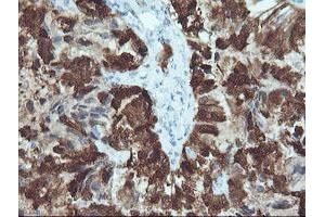 Image no. 1 for anti-Cellular Retinoic Acid Binding Protein 2 (CRABP2) antibody (ABIN1497620) (CRABP2 antibody)