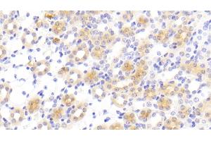 Detection of FUR in Mouse Kidney Tissue using Polyclonal Antibody to Furin (FUR) (FURIN antibody  (AA 578-734))