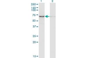 Western Blot analysis of IGF2BP2 expression in transfected 293T cell line by IGF2BP2 monoclonal antibody (M01), clone 4C6. (IGF2BP2 antibody  (AA 1-598))
