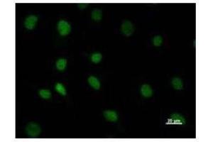 Immunostaining analysis in HeLa cells. (DHX38 antibody)