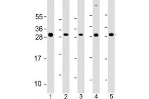 Western blot testing of human 1) SK-BR-3, 2) HeLa, 3) HCT116, 4) MCF-7 and 5) HL-60 cell lysate with NAA10 antibody at 1:2000.