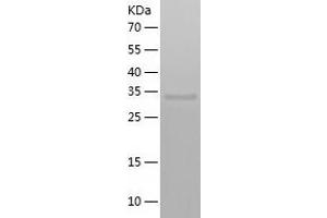 Western Blotting (WB) image for ARP8 Actin-Related Protein 8 Homolog (ACTR8) (AA 1-329) protein (His tag) (ABIN7288862) (ACTR8 Protein (AA 1-329) (His tag))