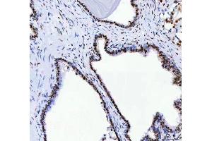 IHC analysis of DDX1 using anti-DDX1 antibody (ABIN7602050). (DDX1 antibody  (AA 562-740))