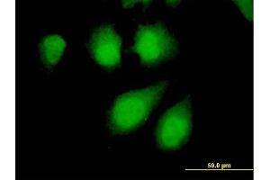 Immunofluorescence of purified MaxPab antibody to PPP2R4 on HeLa cell. (PPP2R4 antibody  (AA 1-323))