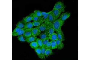 IF analysis of LARP4B using anti-LARP4B antibody (ABIN7600865). (LARP4B antibody  (AA 241-684))