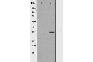 Western blot analysis of extracts of 293 , using THPO antibody. (Thrombopoietin antibody  (Internal Region))