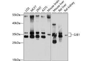 Western blot analysis of extracts of various cell lines, using GJB1 antibody (ABIN6130197, ABIN6141104, ABIN6141105 and ABIN6214243) at 1:1000 dilution. (GJB1 antibody  (AA 214-283))