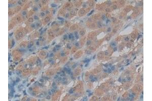 Detection of CTSL in Rat Intestine Tissue using Polyclonal Antibody to Cathepsin L (CTSL) (Cathepsin L antibody  (AA 114-288))