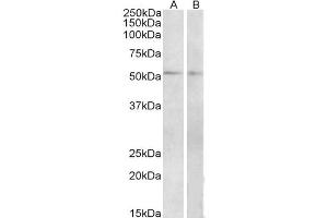 Western Blot (2μg/ml) staining of Mouse (A) and Rat (B) Small Intestine lysate (35μg protein in RIPA buffer). (VIPR1 antibody  (Internal Region))