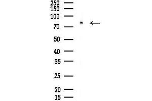 Western blot analysis of lysates from F10-LUC cells(heat-shock 45 min treatment), using GPR149 Antibody at 1/1000 dilution.