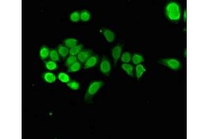 Immunofluorescent analysis of PC-3 cells using ABIN7161848 at dilution of 1:100 and Alexa Fluor 488-congugated AffiniPure Goat Anti-Rabbit IgG(H+L) (NUPR1 antibody  (AA 2-64))