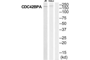 Western Blotting (WB) image for anti-CDC42 Binding Protein Kinase alpha (DMPK-Like) (CDC42BPA) (Internal Region) antibody (ABIN1852716) (CDC42BPA antibody  (Internal Region))