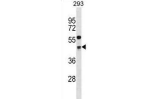 Western Blotting (WB) image for anti-Cyclin G2 (CCNG2) antibody (ABIN2998927)