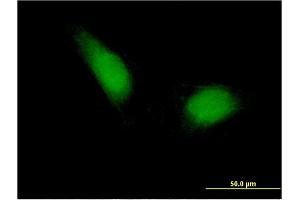 Immunofluorescence of monoclonal antibody to ETS1 on HeLa cell.