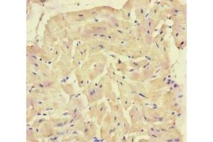 Immunohistochemistry of paraffin-embedded human heart tissue using ABIN7168871 at dilution of 1:100 (SQSTM1 antibody  (AA 16-310))