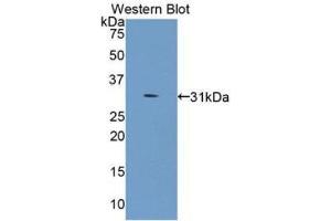 Western Blotting (WB) image for anti-Collagen, Type IV, alpha 5 (COL4A5) (AA 1461-1685) antibody (ABIN3201692) (COL4a5 antibody  (AA 1461-1685))
