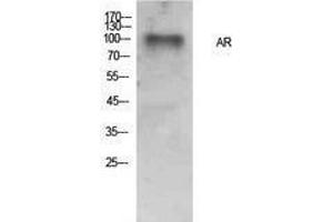 Western Blotting (WB) image for anti-Androgen Receptor (AR) (Internal Region) antibody (ABIN3181394)