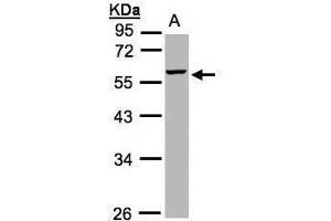 WB Image Sample(30 ug whole cell lysate) A:Hep G2 , 10% SDS PAGE antibody diluted at 1:1000