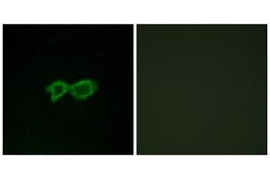Immunofluorescence analysis of LOVO cells, using OR13C4 antibody. (OR13C4 antibody  (Internal Region))
