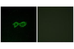 Immunofluorescence analysis of LOVO cells, using OR13C4 antibody.