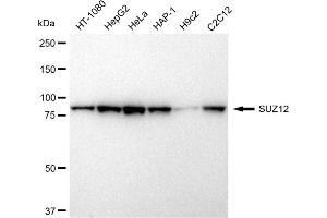 Western blotting analysis using SUZ12 antibody (ABIN7800472).