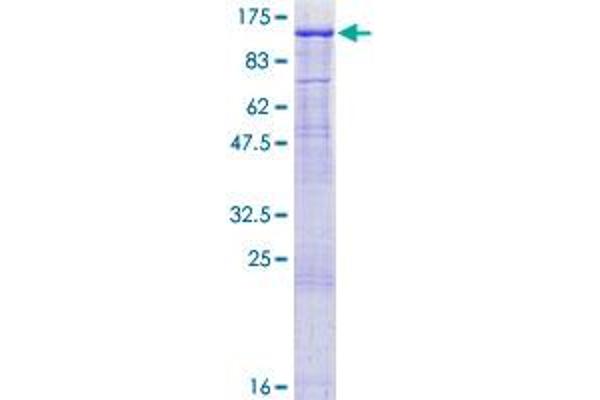MED16 Protein (AA 1-860) (GST tag)