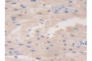 Immunohistochemistry (IHC) image for anti-Receptor Tyrosine-Protein Kinase ErbB-3 (ERBB3) (AA 707-964) antibody (ABIN7440773)