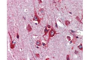 Immunohistochemistry (IHC) image for anti-Transcription Factor AP-2 gamma (Activating Enhancer Binding Protein 2 Gamma) (TFAP2C) (Middle Region) antibody (ABIN2777941) (TFAP2C antibody  (Middle Region))