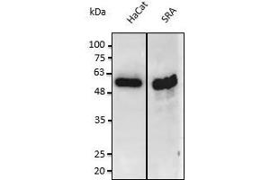 Anti-PS3 Ab at 1/2,500 dilution: lysates at 50 µg of total protein per Iane, rabbit polyclonal to goat lgG (HRP) at 1/10,000 dilution, (p53 antibody  (C-Term))