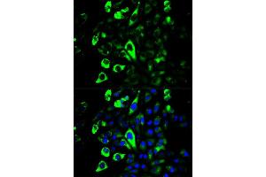 Immunofluorescence (IF) image for anti-Granzyme B (GZMB) antibody (ABIN1875446) (GZMB antibody)
