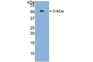 Detection of Recombinant PKM2, Human using Polyclonal Antibody to Pyruvate kinase isozymes M2 (PKM2) (PKM2 antibody  (AA 294-470))