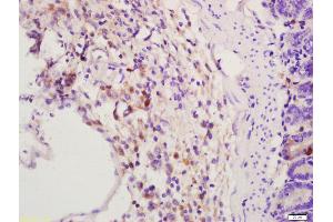 Formalin-fixed and paraffin embedded mouse intestine labeled with Anti-GLP-1(1G9) Monoclonal Antibody, Unconjugated (bsm-0933M) at 1:200 followed by conjugation to the secondary antibody and DAB staining (EHMT1 antibody)