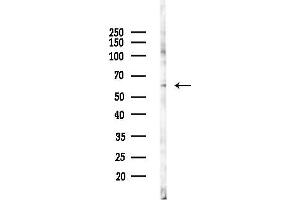 anti-RNA-Binding Region (RNP1, RRM) Containing 3 (RNPC3) antibody