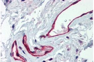 Human Colon, Vessels (formalin-fixed, paraffin-embedded) stained with DARC antibody ABIN337034 at 2. (DARC antibody  (C-Term))