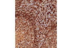 Immunohistochemical analysis of paraffin-embedded human tonsil tissue using (ABIN657755 and ABIN2846737) performed on the Leica® BOND RXm. (HLA-DPB1 antibody  (AA 77-105))
