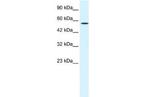 WB Suggested Anti-MEIS2 Antibody Titration:  1. (MEIS2 antibody  (N-Term))