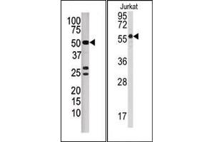 Image no. 1 for anti-Protein Phosphatase 3, Catalytic Subunit, beta Isozyme (PPP3CB) (N-Term) antibody (ABIN360810) (PPP3CB antibody  (N-Term))