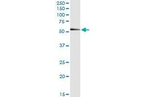 Immunoprecipitation of RNF25 transfected lysate using anti-RNF25 MaxPab rabbit polyclonal antibody and Protein A Magnetic Bead , and immunoblotted with RNF25 MaxPab mouse polyclonal antibody (B01) . (RNF25 antibody  (AA 1-459))