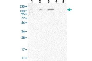 Western blot analysis of Lane 1: RT-4, Lane 2: U-251 MG, Lane 3: Human Plasma, Lane 4: Liver, Lane 5: Tonsil with SPOCD1 polyclonal antibody  at 1:250-1:500 dilution. (SPOCD1 antibody)